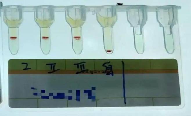 혈액 샘플 [지무뉴스 캡처. 재판매 및 DB금지]