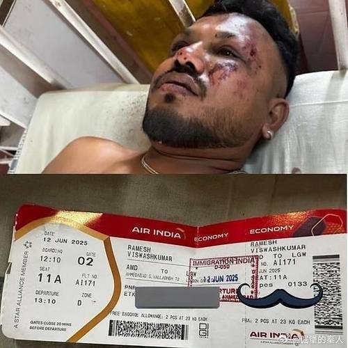 인도 여객기 추락사고의 유일한 생존자 [웨이보 캡처]