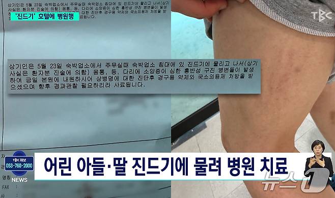 대구의 한 호텔 방에서 진드기가 발견됐다. (TBC 화면 갈무리)