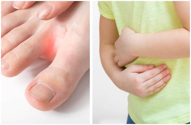 고온다습한 장마철엔 무좀과 식중독 등 위험이 높은 만큼 세심한 건강관리가 필요하다. 게티이미지뱅크