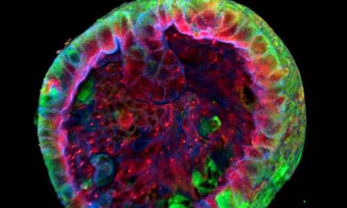 신장 오가노이드(미니 신장) [네이처 바이오테크놀러지 제공]