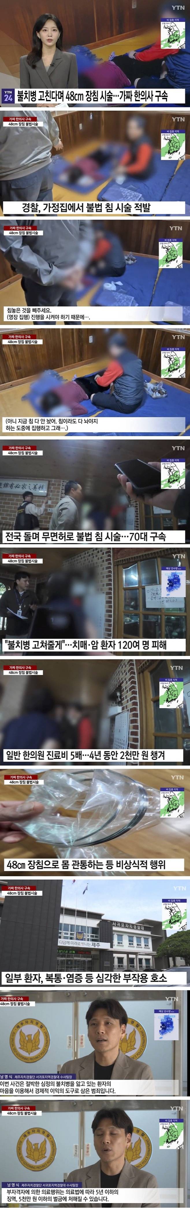 환자 몸에 48cm 장침 쑤셔넣은 한의사