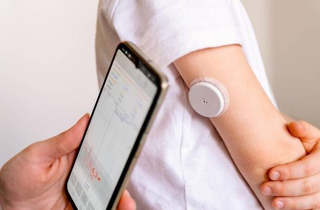 연속혈당측정기를 사용해 혈당을 측정하는 모습. 게티이미지
