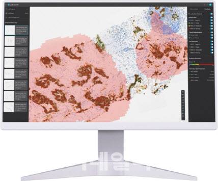 루닛 바이오마커 제품 모습 (사진=루닛)