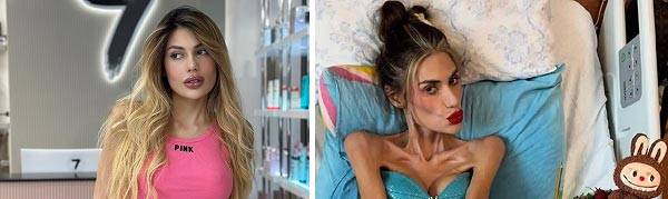 수년간 심각한 거식증을 앓던 30대 인플루언서가 결국 사망한 사연이 공개됐다./사진=니드투노우