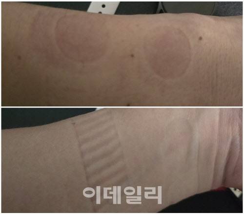 갤럭시워치7과 애플워치10을 한 시간 가량 착용하고 러닝한 이후 손목. 좌측에 밴드 자국이 선명한 것이 갤럭시워치7를 착용한 자리다.(사진=윤정훈 기자)