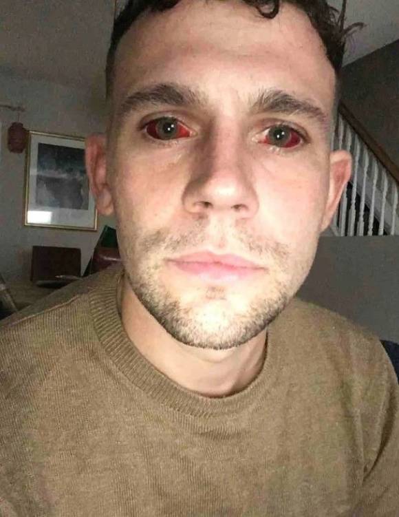 15년간 코카인에 중독됐던 한 영국의 데이브 멀렌이 5일 연속 코카인을 흡입했다가 겪은 극단적인 경험을 공유하며 약물 중독의 위험성을 경고하고 나섰다. 데이브 멀렌 틱톡(darkdays2brighterways)