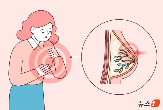 유방 멍울, 유방 통증 등의 증상이 있다면 의사의 진료 후 추가 검사 여부를 결정해야 한다. ⓒ News1 양혜림 디자이너