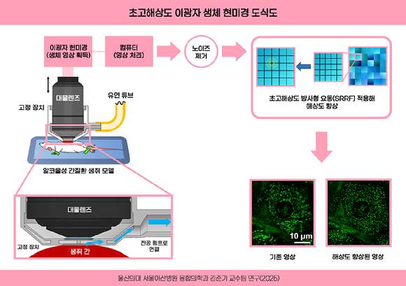 초고해상도 이광자 생체 현미경 도식도. [사진=서울아산병원]