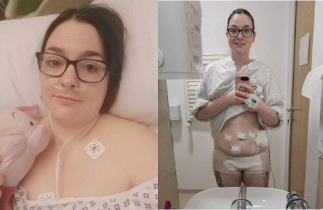 어린 시절부터 반복된 극심한 생리통에도 의료진으로부터 외면당한 한 여성이 20여 년간 방치 끝에 여러 장기를 적출하고, 신경 손상으로까지 고통을 겪은 사연이 공유됐다. [사진=SNS]