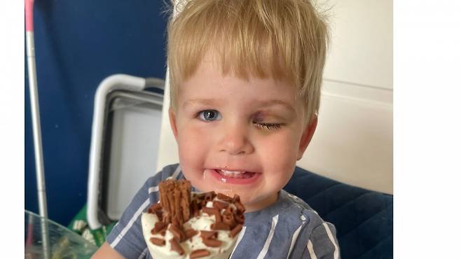 영국에서 두 살배기 아이가 어린이집에서 찍힌 사진 덕분에 희귀 안구암 ‘망막아세포종’을 조기 진단받았다. 사진 속 왼쪽 눈의 비정상적인 반사가 단서가 됐고, 정밀 검사 끝에 악성 종양이 확인돼 안구를 적출했다. 전문가들은 사진 속 ‘하얀 동공’이 암의 초기 신호일 수 있다며, 눈에 이상이 보이면 즉시 안과 검진을 받으라고 강조했다. (사진=JustGiving 캡처)