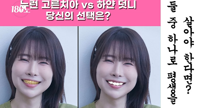 여자친구랑 키스 하는데 누런 고른치아 VS 하얀 덧니