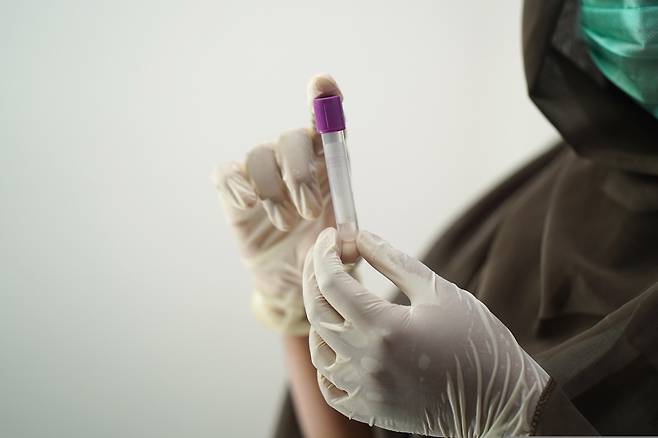 미국 시카고대 연구진이 디옥시리보핵산(DNA) 대신 리보핵산(RNA)을 활용해, 대장암을 조기에 감지할 수 있는 새로운 액체 생검 기술을 개발했다./pixabay