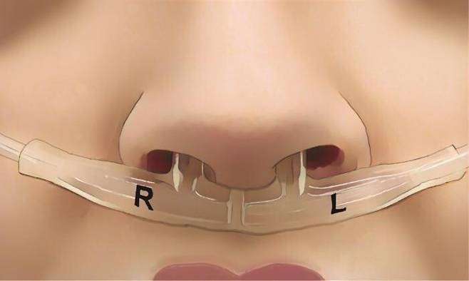 연구진이 호흡 지문을 밝히기 위해 개발한 호흡시 공기 흐름 측정기. 바이츠만과학연구소 제공