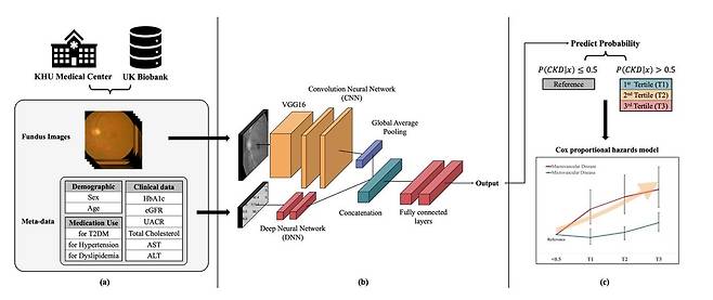 경희대학교 의과대학 연동건·이상열 교수 연구팀이 국내외 대규모 의료 빅데이터를 기반으로 제2형 당뇨병 환자에게 만성신장질환이 5년 이내 발병할 위험을 조기에 예측할 수 있는 다중모달 인공지능 모델을 개발했다. 사진은 망막 영상과 임상·인구학 정보 통합 기반 다중 모달 딥러닝 모델 구조 및 CKD 위험 예측 연구 개요.