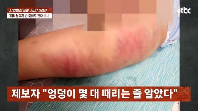충남 아산시 한 태권도장에서 초등학교 5학년 아들이 관장으로부터 폭행당했다는 학부모 주장이 제기됐다. /사진=JTBC '사건반장' 캡처