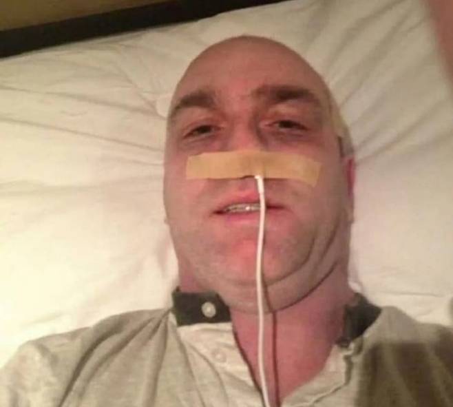 케리가 콧구멍에 아이폰 충전기를 꽂은 사진. /더선