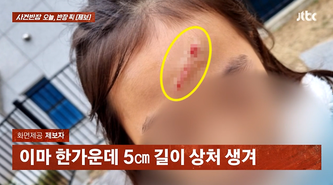 지난 2023년 12월 경남 김해의 한 학원 건물 엘리베이터 내 천장에서 커다란 구조물이 아이들을 덮치는 사고가 발생했다. 이 사고로 초등학생 여자아이의 이마가 5cm 찢어졌다. /사진=JTBC '사건반장' 캡처