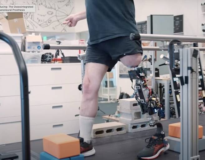 미국 MIT 연구팀이 새롭게 개발한 인공무릎을 이식한 환자들은 장애물을 훨씬 쉽게 넘을 수 있었다고 응답했다. [사진=MIT 홈페이지 갈무리]