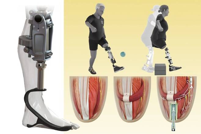 연구팀에 따르면 새로운 인공무릎은 근육이나 신경과 직접 신호를 주고받으며 자연스러운 움직임을 지원한다. [사진=MIT 홈페이지 갈무리]