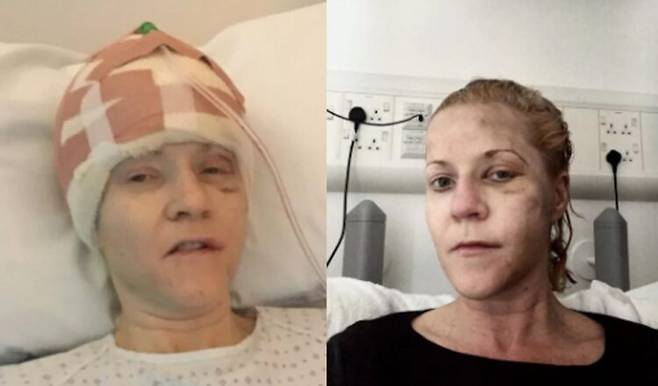 영국 서머싯주 포티스헤드에 사는 여성 쇼나 하이론스(Shona Hirons·50대 초반)는 일곱 번이나 죽을 뻔한 극적인 인생을 살아왔다. [사진=SNS]