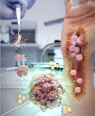 나노바이오시스템이 개발한 젤라틴 나노입자-줄기세포 융합 첨단재생바이오 치료제 개념도.