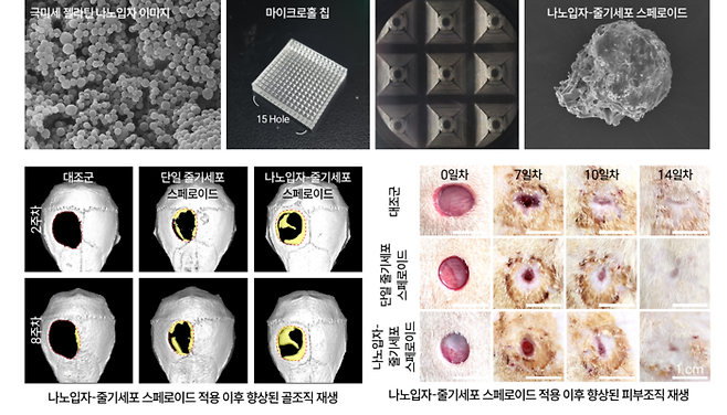 나노입자-줄기세포 융합 첨단재생바이오 치료제를 활용한 골재생 및 피부재생 효과.