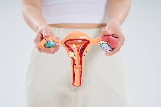 생리 중 출혈이 과한 날이 잦다면 자궁내막증 등 부인과 질환을 의심해볼 수 있다. [사진=게티이미지뱅크]