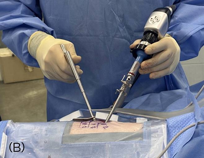 양방향 척추내시경 실제 수술 모습(본동물의료센터 제공) ⓒ 뉴스1