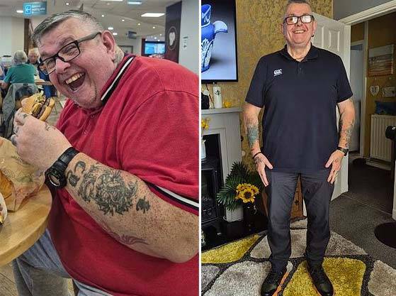 퍼니스의 다이어트 전(왼)과 후(오)의 모습./사진=데일리 메일