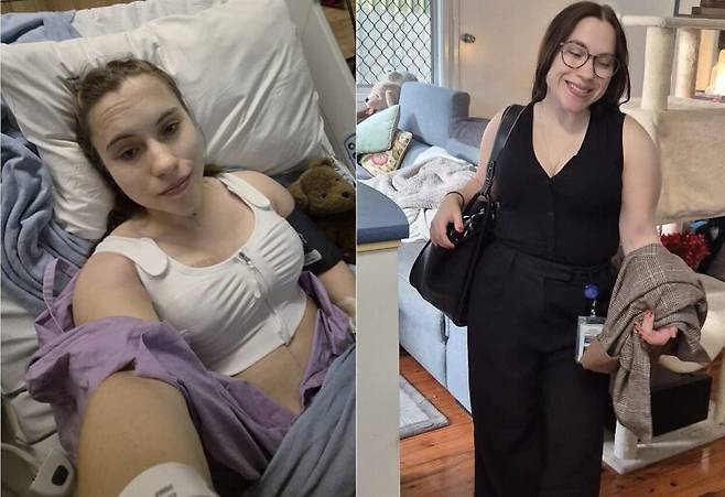 신체·정신적 고통을 겪었던 그는 결국 가슴 축소술을 받고 H컵에서 D컵으로 변신했다. [사진=SNS]