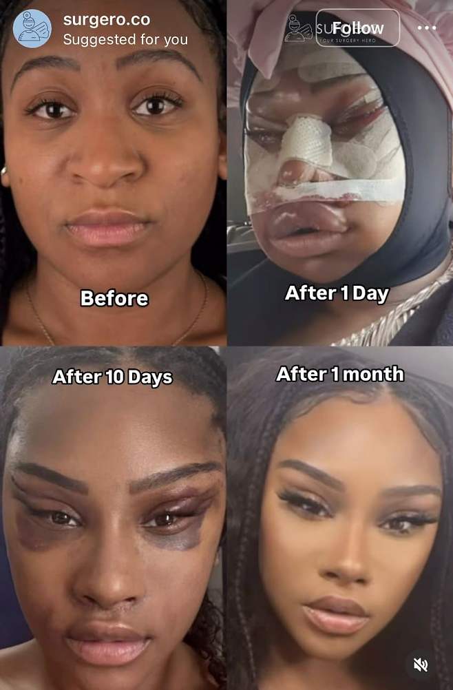 7d9e817eb18368f123eb85e0349c706cac5b8ae58fbcb1f4a1830b2f495ddaa890222beb997740f9eb6ead8e0b7e9f78da49bcf9