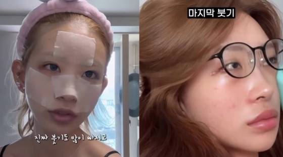 /사진=최준희 SNS