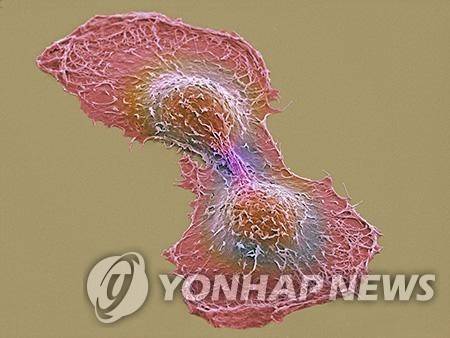 암세포 두 개의 전자현미경 영상 이미지 [UCSD NCMIR 토마스 데링크 제공]