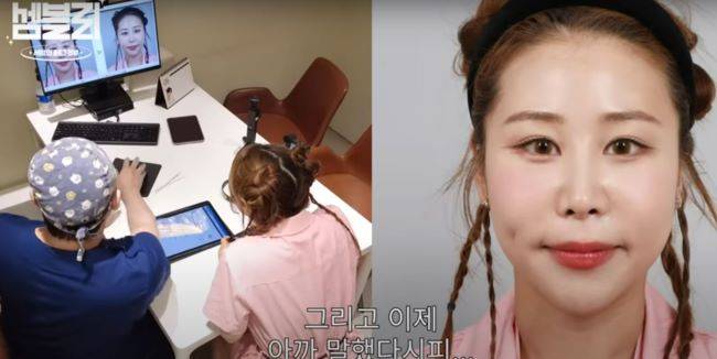 박세미의 성형 후 시뮬레이션 사진. /사진=14F 일사에프