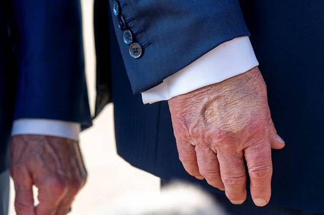 메릴랜드 주 앤드루스 합동기지에 지난 15일(현지시간) 도착한 도널드 트럼프 미국 대통령의 오른손 일부가 메이크업으로 덮여 있는 모습. 로이터연합뉴스