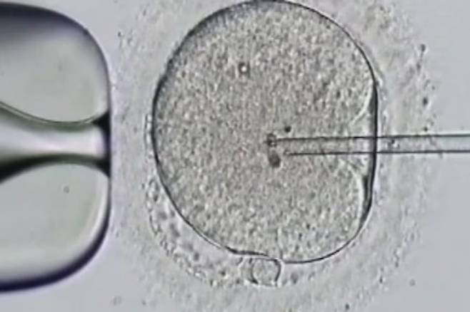 체외수정 과정./ABC 캡처