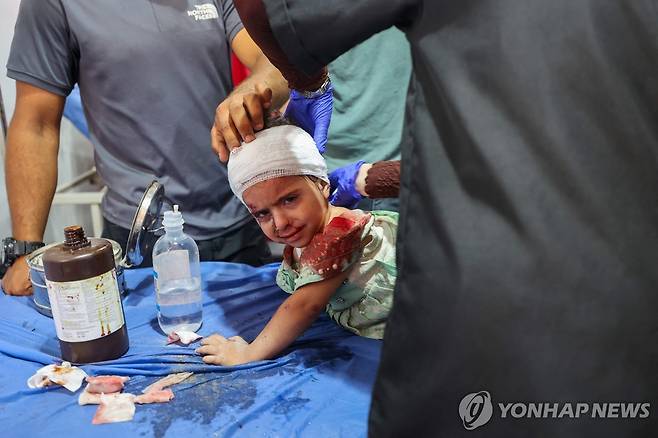 19일(현지시간) 가자지구에서 공습으로 다쳐 치료받고 있는 어린이 [AFP 연합뉴스 자료사진 재판매 및 DB 금지]