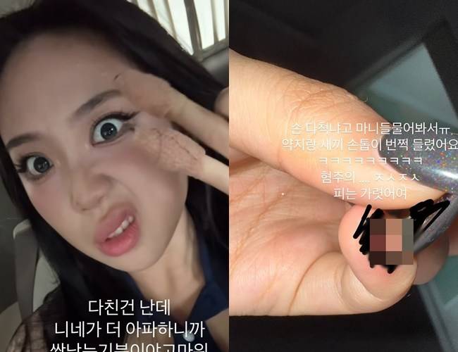 사진=이영지 소셜미디어