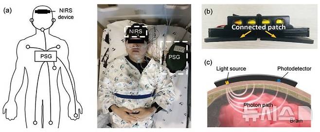[서울=뉴시스]연구팀이 개발한 무선 근적외선 분광기. (사진= 분당서울대병원 제공) 2025.07.23. photo@newsis.com.