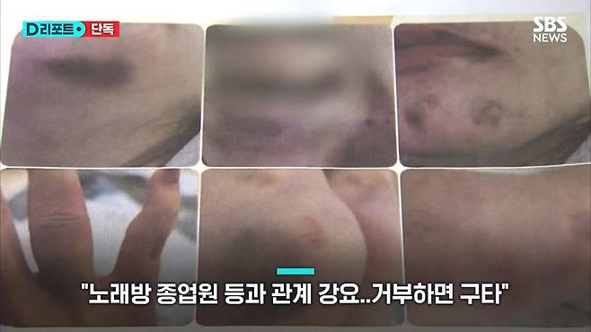 B 씨가 남편으로부터 폭행을 당한 뒤 찍은 사진이라고 주장한 증거.[SBS 캡처]