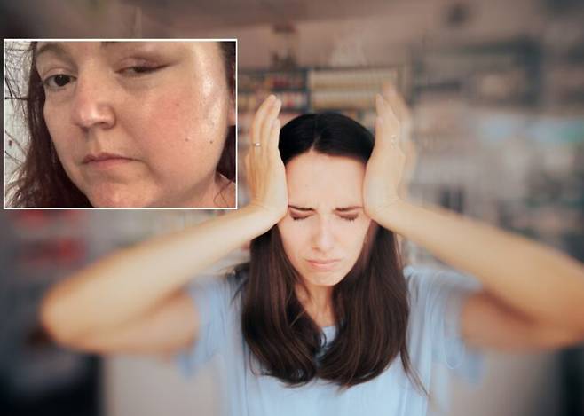 두통과 피로, 불안감, 시야 이상과 같은 증상을 곧 폐경이 되려는 호르몬 변화 때문이라고 여긴 여성이 결국 뇌수막종이라는 뇌종양 진단을 받은 사연이 공유됐다. [배경 사진=게티이미지뱅크/ 상단 여성 -사라히치먼 SNS]