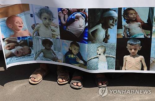 예멘 시위대가 들고 나온 기아 상태 가자 어린이들 사진  [EPA 연합뉴스 자료사진. 재판매 및 DB 금지]