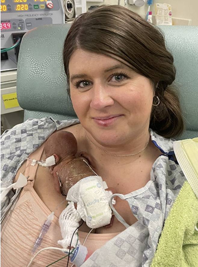 21주 만에 태어나 세계에서 가장 어린 조산아로 기네스북에 등재된 아이가 무사히 첫 돌을 맞았다./사진=기네스 세계기록 홈페이지