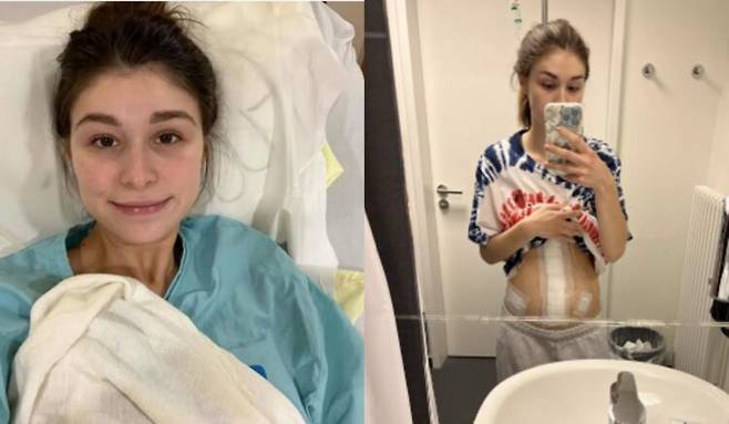 미국 클리블랜드 출신의 29세 여성 크리스티나 바이우스-로작은 어느 날 갑자기 심한 구토와 복통, 메스꺼움에 시달리며 급격한 체중 감소를 겪었다. [사진=고펀드미]