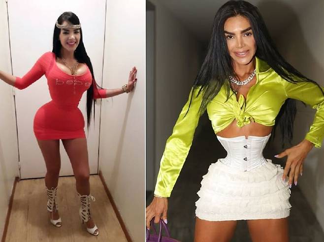 베네수엘라 출신 알레이라 아벤다노(33)는 하루 23시간 코르셋을 착용한다. 출처=SNS