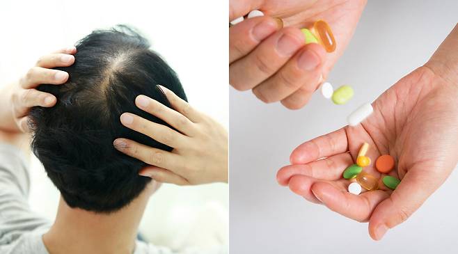 과도한 영양제 섭취가&nbsp;탈모나&nbsp;피부 질환, 간 손상 등 치명적인 부작용을 불러올 수 있다는 연구결과가 나왔다.&nbsp;클립아트코리아 제공