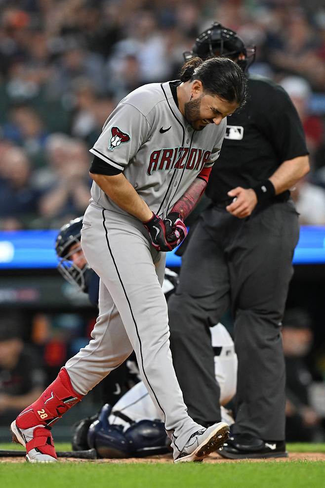 수아레즈가 지난 29일(한국시각) 디트로이트전에서 9회 손에 사구를 맞고 고통스러워하고 있다. Imagn Images연합뉴스