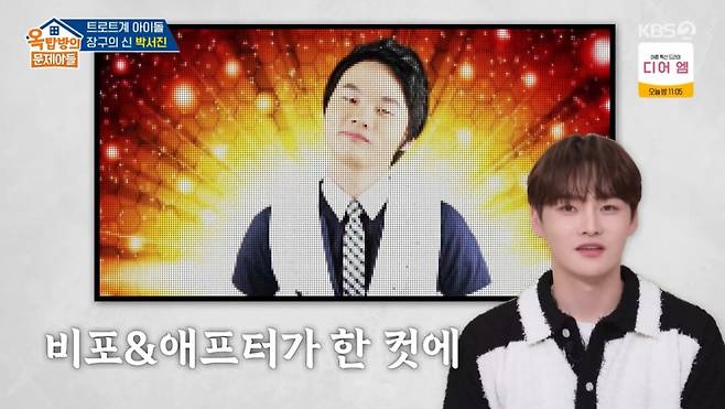 박서진이 성형 수술 사실을 쿨하게 고백했다. /사진=KBS2 방송화면 캡처
