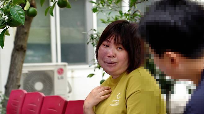 안면 장애가 있는 김민혜씨는 소수 장애인으로 살아가며 겪는 어려움을 전했다.